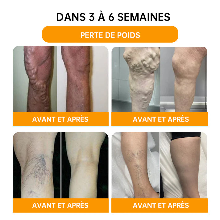 NEGUSY™ Perles de Bain Minceur et Détox aux 30 Herbes - 🦵👩‍⚕️ (Certification LANA, Association Lymphatique des États-Unis)