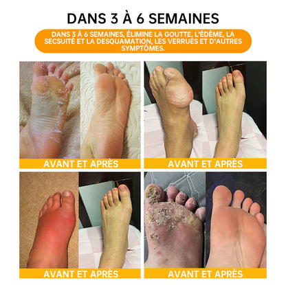 NEGUSY™ Perles de Bain Minceur et Détox aux 30 Herbes - 🦵👩‍⚕️ (Certification LANA, Association Lymphatique des États-Unis)