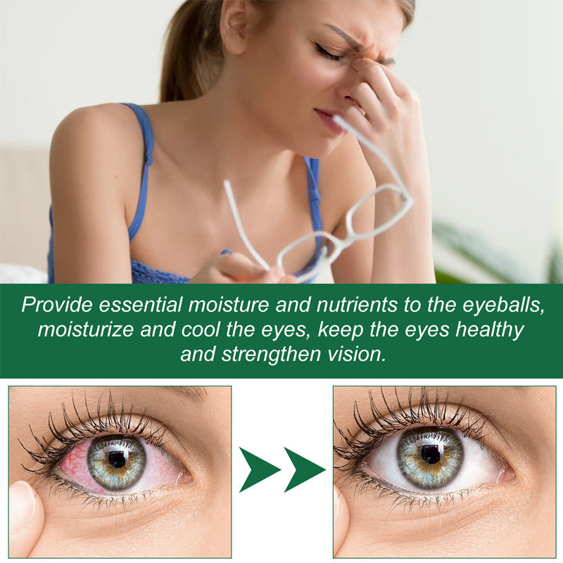 Seurico™Presbyopia Eye Drops